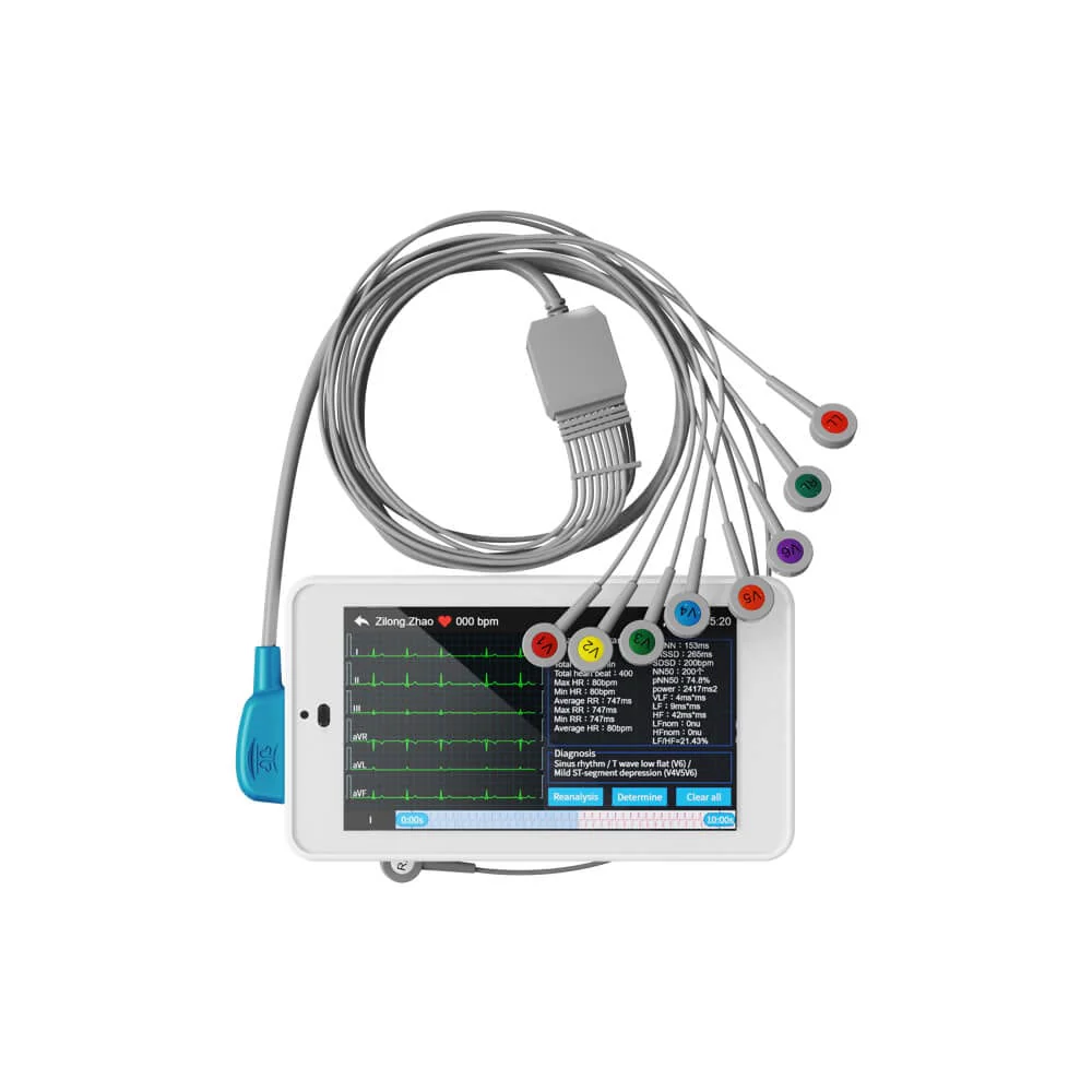 electrocardiograf ekg 1212 canale si derivatii portabil pentru adulti si copii 813149 1800x1800